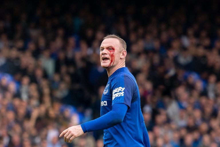 Wayne Rooney, head injury, blood, Everton